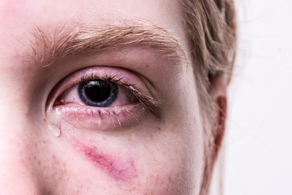EMDR-Therapie: Ursprung, Wirksamkeit & 8‑Phasen‑Ablauf