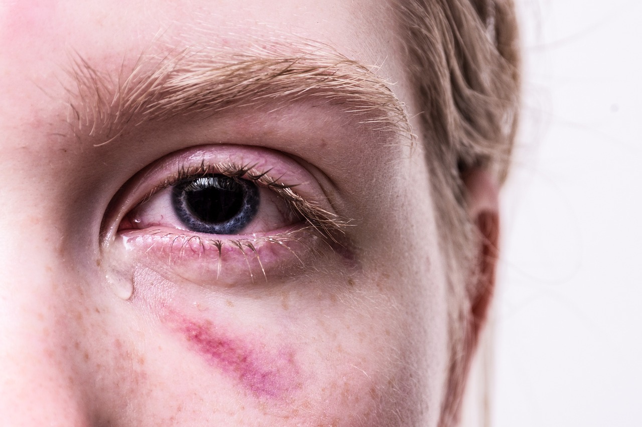 EMDR-Therapie: Ursprung, Wirksamkeit & 8‑Phasen‑Ablauf